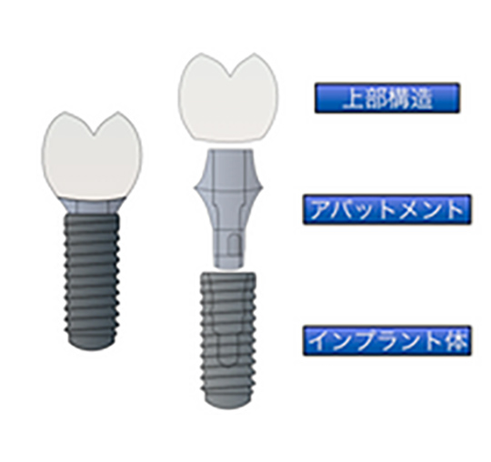 ⼟台（アバットメント）の連結